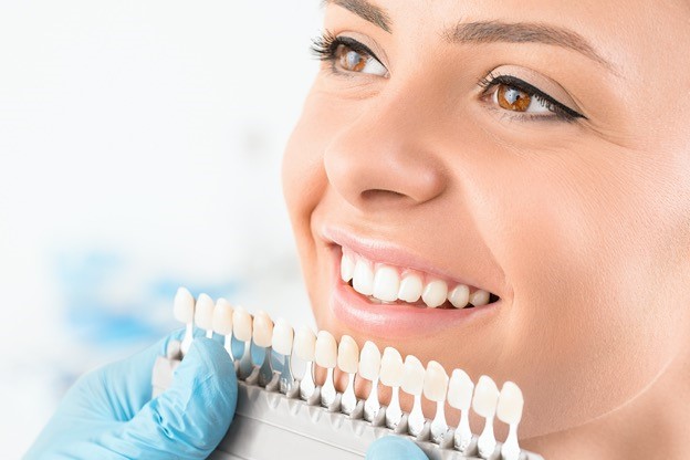 Email helps dentist upsell to veneers